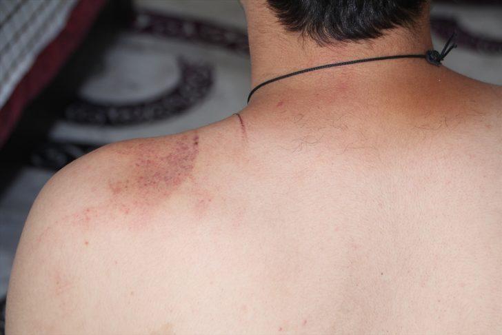 Antalya'da epilepsi hastası gencin darbedilmesi güvenlik kamerasınca kaydedildi G1