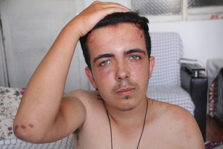 Antalya'da epilepsi hastası gencin darbedilmesi güvenlik kamerasınca kaydedildi G2