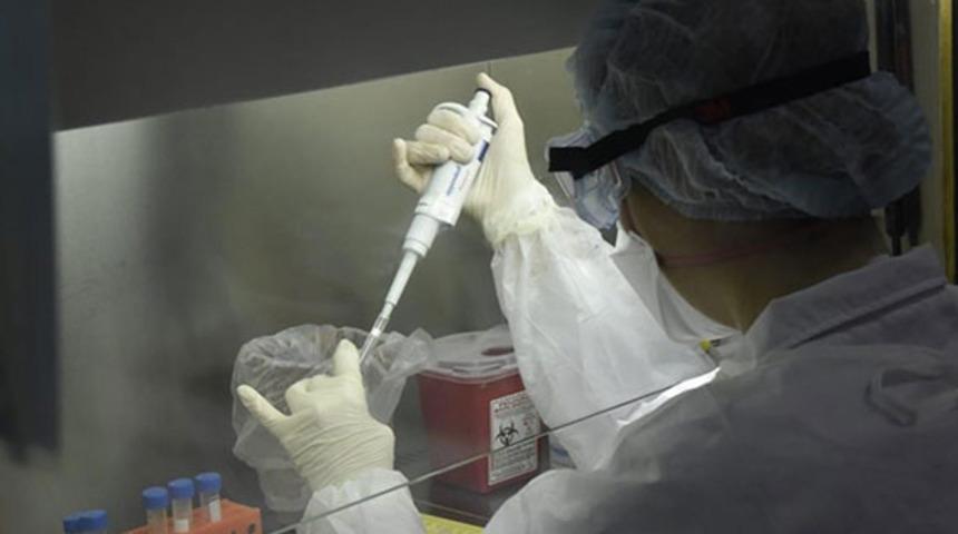 Arjantin'de ilk kez kara mantar hastalığı görüldü! Duymada problem yaşayınca fark etti