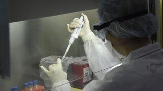 Arjantin'de ilk kez kara mantar hastalığı görüldü! Duymada problem yaşayınca fark etti