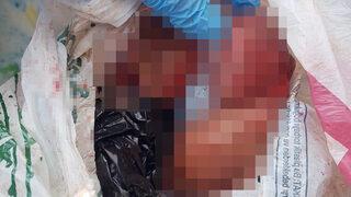 Antalya'da korkunç olay! Cadde ortasında düşük yapan kadın, bebeğini çöpe attı