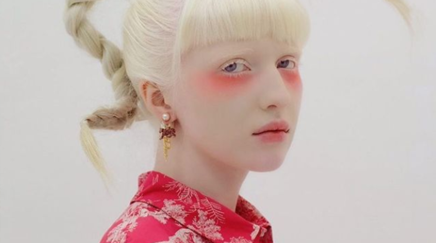 Güzellik kalıplarını alt üst ederek yeni bir güzellik algısı yaratan model Nastya Kumarova sosyal medyanın dikkatini çekti