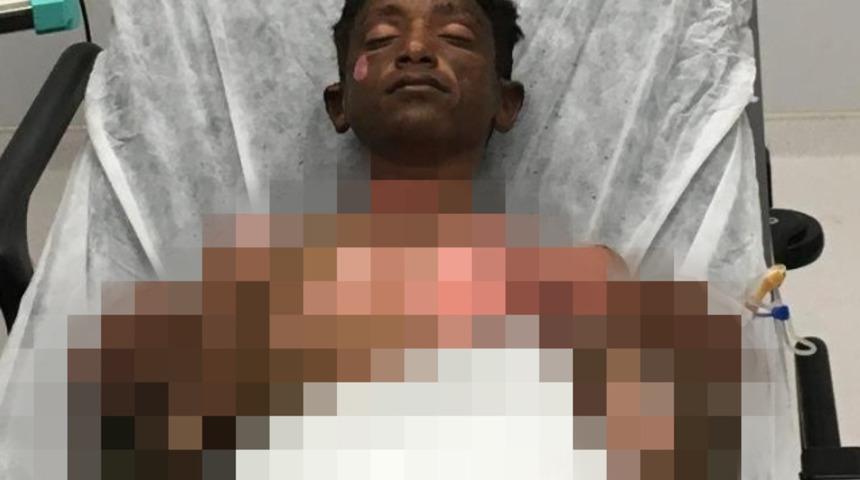 Kahreden ölüm! Tinerin patlaması sonucu yaralanmıştı, 1 aydır verdiği yaşam mücadelesini kaybetti