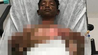 Kahreden ölüm! Tinerin patlaması sonucu yaralanmıştı, 1 aydır verdiği yaşam mücadelesini kaybetti