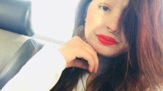 Uğradığı asit saldırısı sonucunda hayatı tamamen değişen Reshma Qureshi’nin hikayesi birçok kadına ilham kaynağı oldu