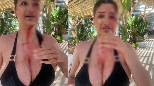 Şezlong kavgası kanlı bitti! Irkçılık yapıldı iddiası: Şişeyi fırlatan biz olsaydık tutuklanmıştık