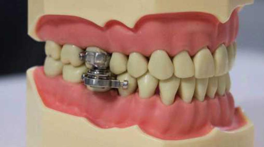 Sosyal medya bu kilo verme cihazını konuşuyor! ''İşkence cihazı mı?''