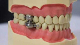 Sosyal medya bu kilo verme cihazını konuşuyor! ''İşkence cihazı mı?''