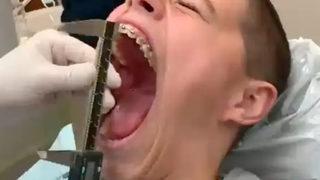 ''Yok artık'' dedirten rekor! Ağız açıklığı yetkilileri bile şaşkına çevirdi