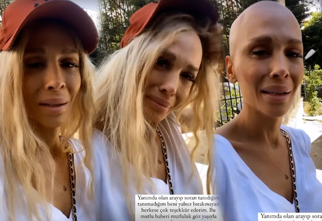 Şarkıcı Şimal kanseri yendiğini peruğunu atarak duyurdu 