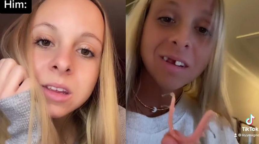 Takma dişleriyle fenomen oldu, sosyal medyada gerçek olmaya davet etti: Erkekler için hayal kırıklığı ama...