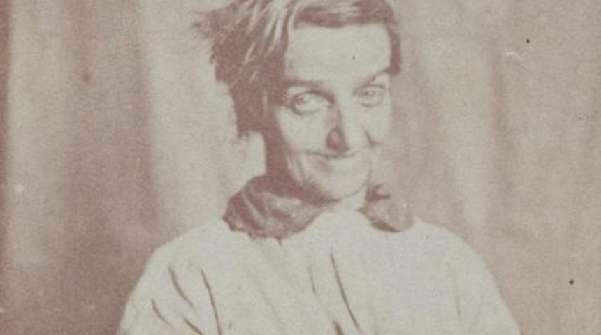 Hastalarının fotoğraflarını çekerek teşhis koyan Hugh Welch Diamond psikoloji alanında bir devrim başlattı