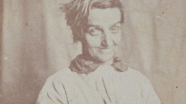 Hastalarının fotoğraflarını çekerek teşhis koyan Hugh Welch Diamond psikoloji alanında bir devrim başlattı