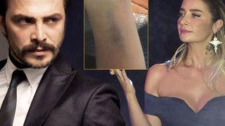 Sıla ve Ahmet Kural arasındaki darp davasında yeni gelişme! Sıla 'yapma' diye bağırıyordu