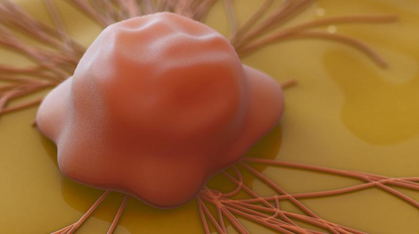 Türkiye kanser vakası artıyor