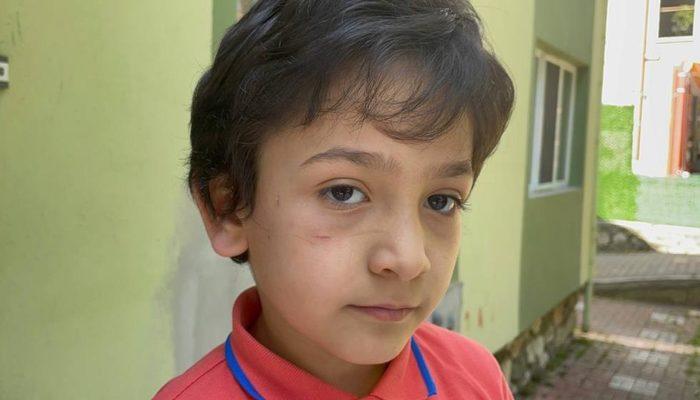 Sokak köpeği 8 yaşındaki Mehmet'e dehşeti yaşattı