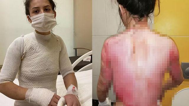 Eşinin kaynar suyla yaktığı Rukiye A: Ölmek istemiyorum