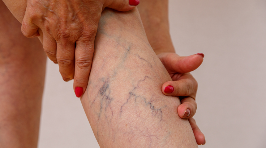 Uzman isim uyardı! Bu varis tipleri tehlikeli oluyor