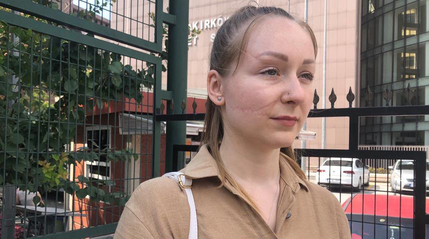 Falçatalı saldırıya uğramıştı: Yüzümün yarısı elimdeydi, öleceğim diye çok korktum