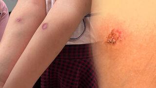 İstanbul'da sivrisinek kabusu! Uzman isim uyardı: En yakın sağlık kuruluşuna başvurun