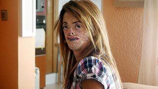 Vampir efsanesi gerçeğe dönüştü! Kişide kan içme isteği uyandıran korkunç bir hastalık: Porfiria