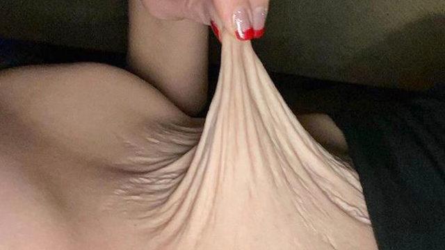 Doğum sonrası karnının görüntüsü şaşkına çevirdi: Pizza hamuru gibiydi! 