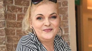 Nurseli İdiz'den çarpıcı botoks itirafı!