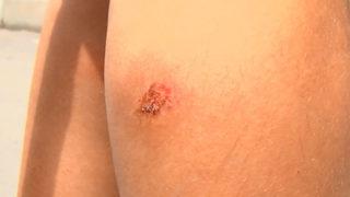 İstanbul'da sivrisinek kabusu büyüyor! İBB SMS ile uyardı