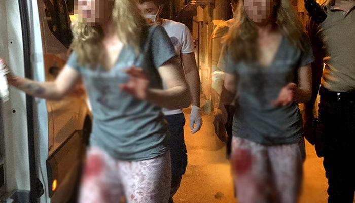 Adana'da iki kadın arasında kavga! Kanlar içinde kaldı