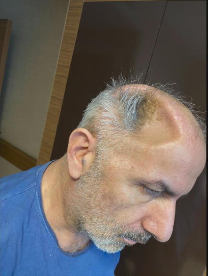 Kafatası kemiklerini 5 ay karnında taşıdı! Asıl kabus daha sonra başladı G2