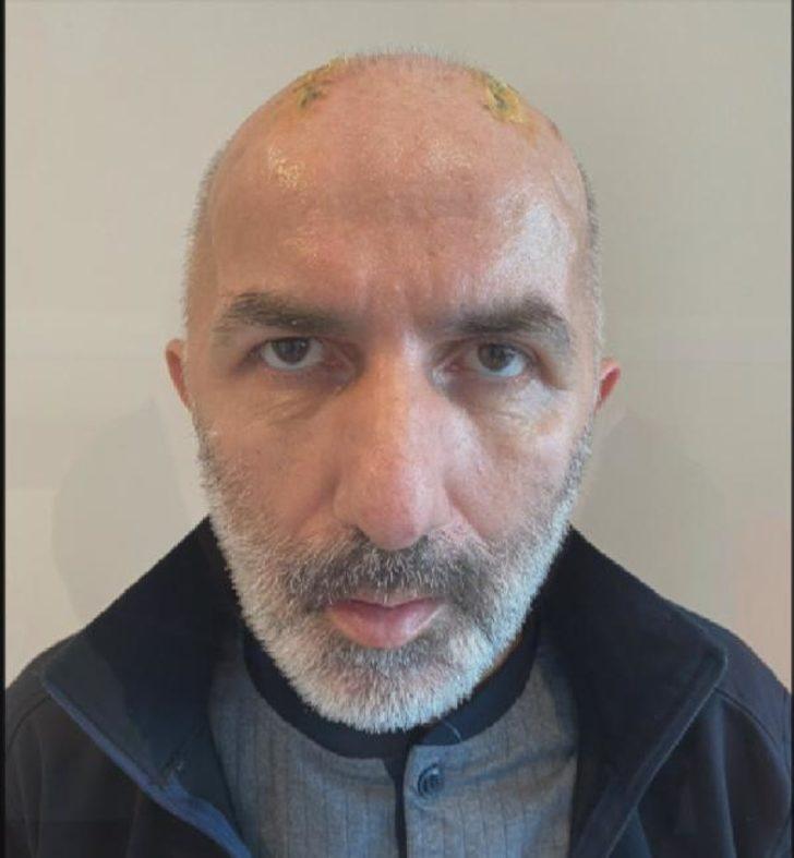 Kafatası kemiklerini 5 ay karnında taşıdı! Asıl kabus daha sonra başladı G4