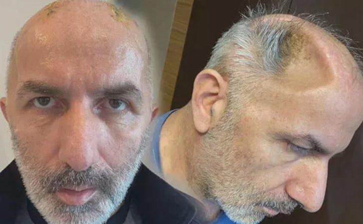 Kafatası kemiklerini 5 ay karnında taşıdı! Asıl kabus daha sonra başladı G5