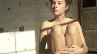 Tüylerini almayı bıraktıktan sonra hikayesi filme konu oldu! İşte Amy Anam Cara’nın cesaret isteyen öyküsü...