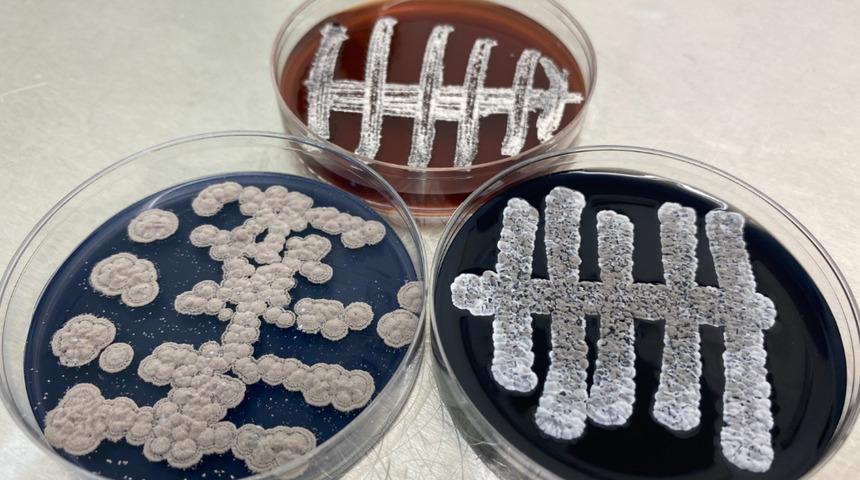 Türk bilim insanlarından çok konuşulacak araştırma! 2 yıllık çalışmada 60 yeni bakteri türü keşfedildi