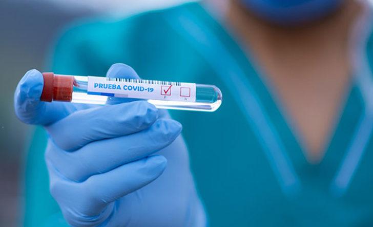 Delta varyantı belirtileri nelerdir? Delta varyantı vaka sayısı kaç? Bakan Koca açıkladı! G5