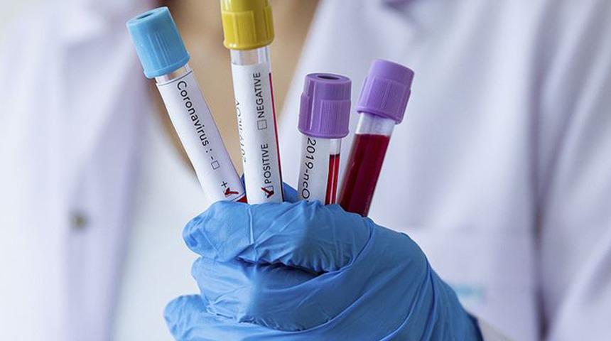 Çarpıcı Kovid-19 araştırması! Bilim insanları, 25 yaşındaki İtalyan kadının peşinde