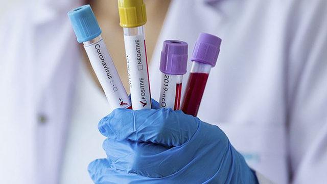 Çarpıcı Kovid-19 araştırması! Bilim insanları, 25 yaşındaki İtalyan kadının peşinde