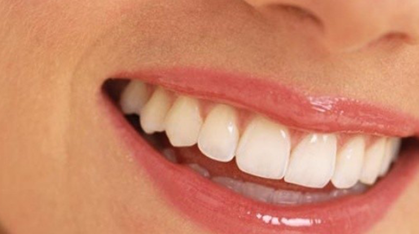 Gülüş tasarımı nedir? Mükemmel gülüş planlaması nasıl yapılır?