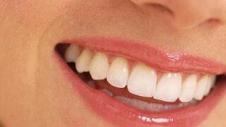 Gülüş tasarımı nedir? Mükemmel gülüş planlaması nasıl yapılır?