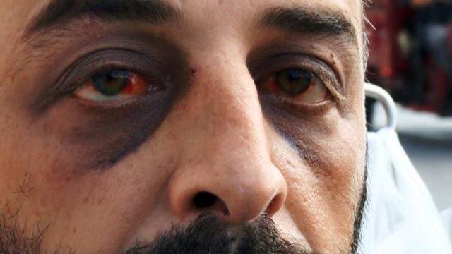 Dehşete düşüren olay: 10 gün yaşam savaşı verdi! Doktorlar öldü zannetti