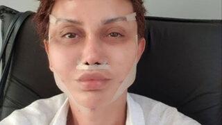 Serap Paköz'den operasyon sonrası yeni poz 