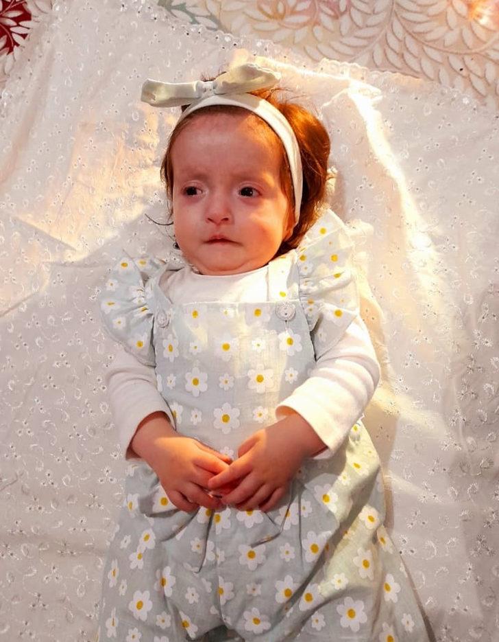 Dünyada sadece 27 kişide tespit edildi! "Bir mucize olsun, kızım yaşasın" G3