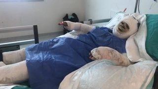 Her satırı korkunç! Üzerine benzin döküp ateşe verdi, yanmasını izledi