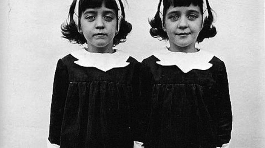 Reenkarnasyona inanmayanları bile ürkütecek! Pollock ikizleri yaşadıklarıyla tarihe damga vurdu