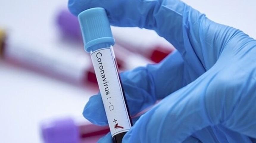 Tokyo 2020 öncesi iki sporcuda koronavirüs tespit edildi