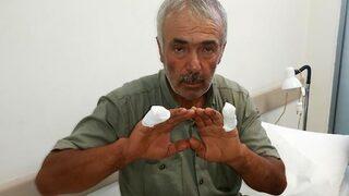 Hayvan otlatırken dehşeti yaşadı! Kurt saldırısından bakın nasıl kurtuldu