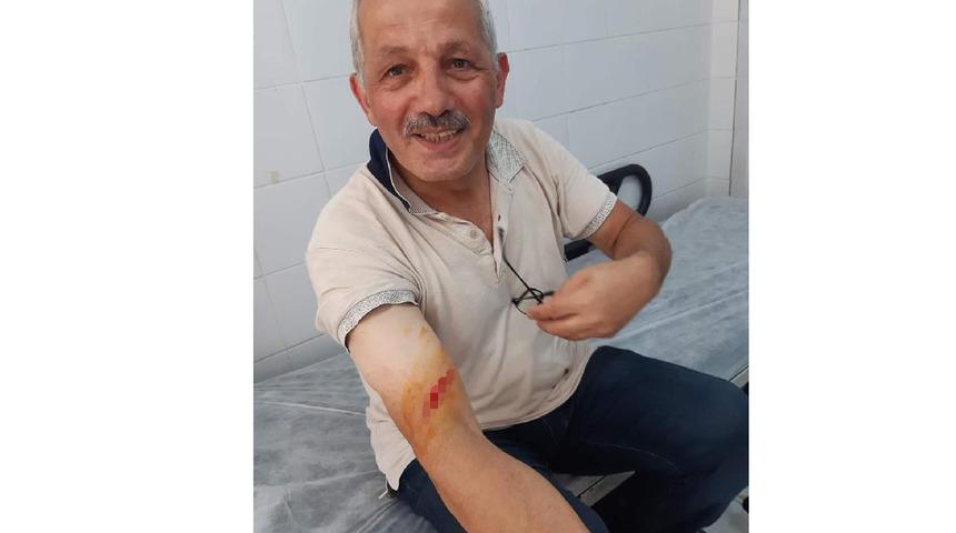 Trabzon'da Köprübaşı Belediye Başkanı Ali Aydın, kurban keserken yaralandı