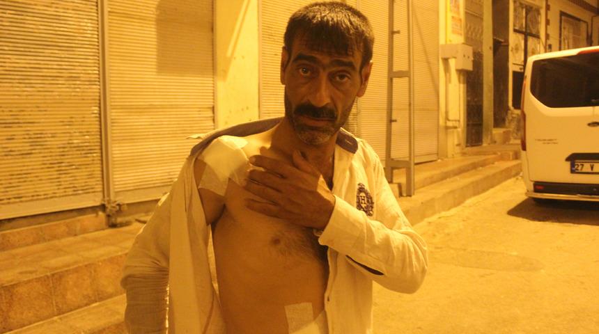 Gaziantep'te akılalmaz olay! Damda çay içerken saçmaların hedefi oldu