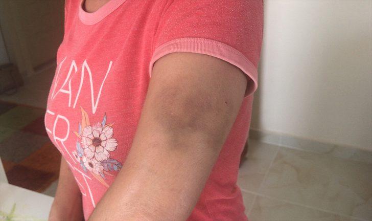 Adana'da kocası tarafından darbedildiğini ve şikayetçi olamaması için alıkonulduğunu belirten kadın polise başvurdu G2