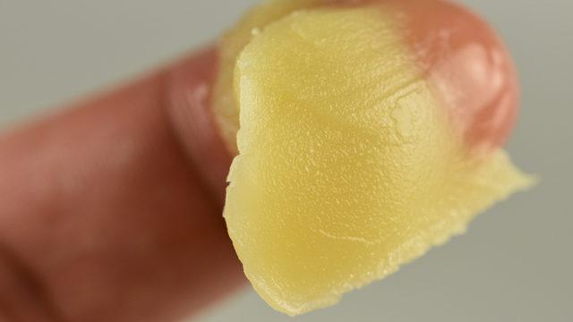 Aniden başlayan burun kanamasını durdurmak için uygulayabileceğiniz 7 yöntem